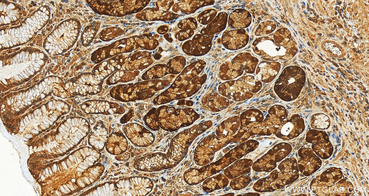 Immunohistochemistry (IHC) staining of human stomach tissue using LGTN Polyclonal antibody (12840-1-AP)