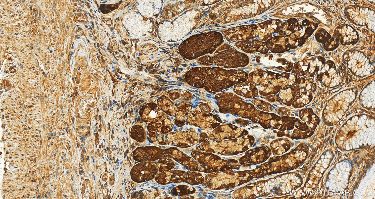 Immunohistochemistry (IHC) staining of human stomach tissue using LGTN Polyclonal antibody (12840-1-AP)