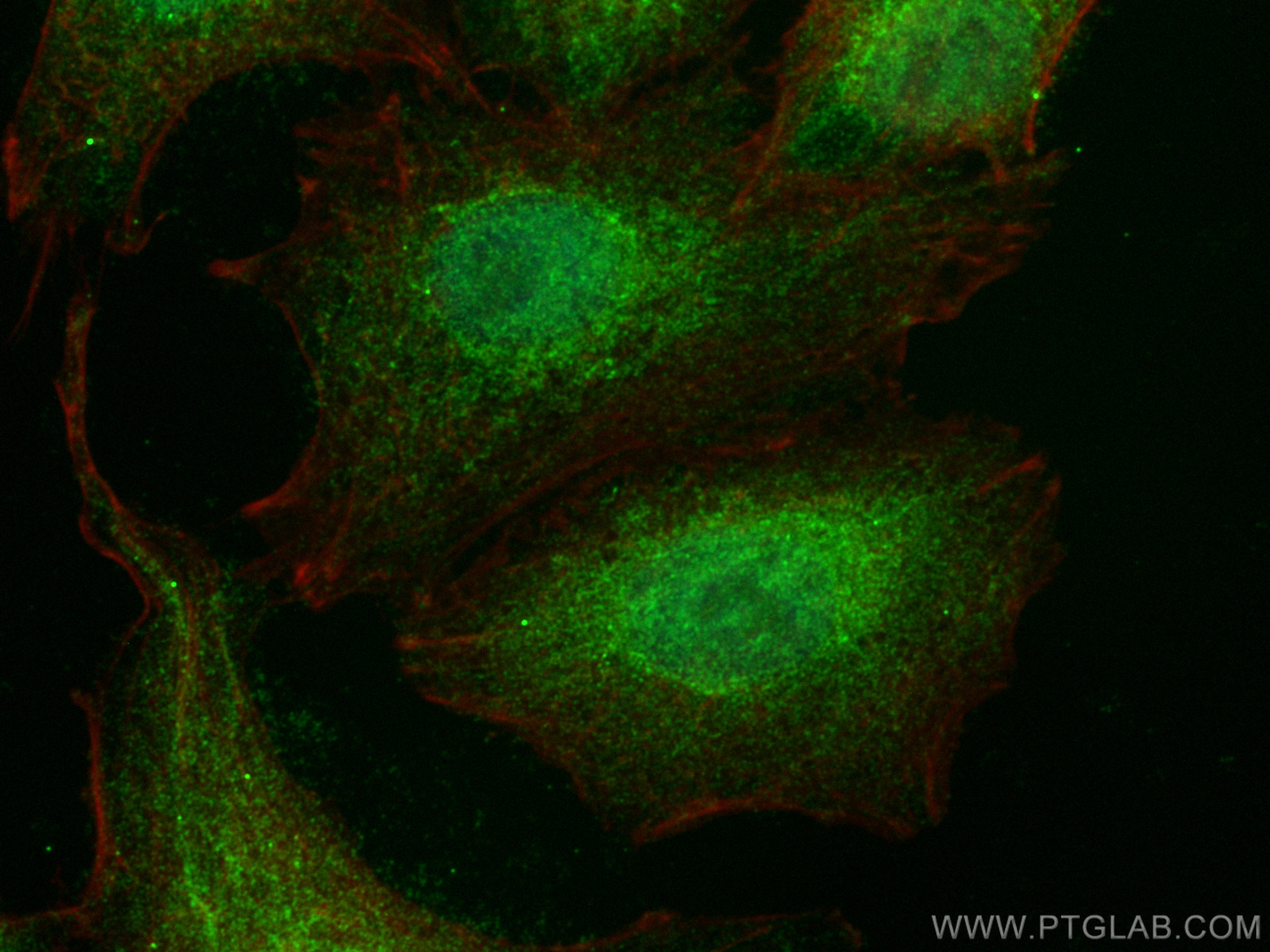 Immunofluorescence (IF) / fluorescent staining of A549 cells using LHX8 Polyclonal antibody (30722-1-AP)