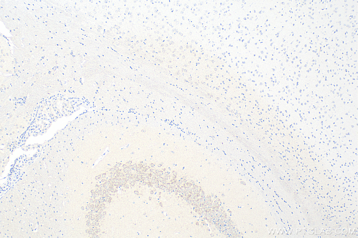 Immunohistochemistry (IHC) staining of mouse brain tissue using LIAS Monoclonal antibody (67298-1-Ig)