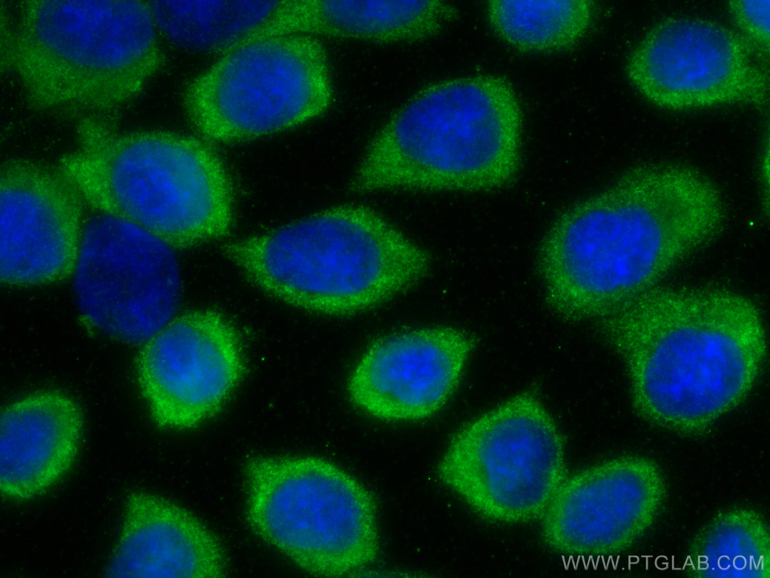 Immunofluorescence (IF) / fluorescent staining of A431 cells using LIF Polyclonal antibody (26757-1-AP)