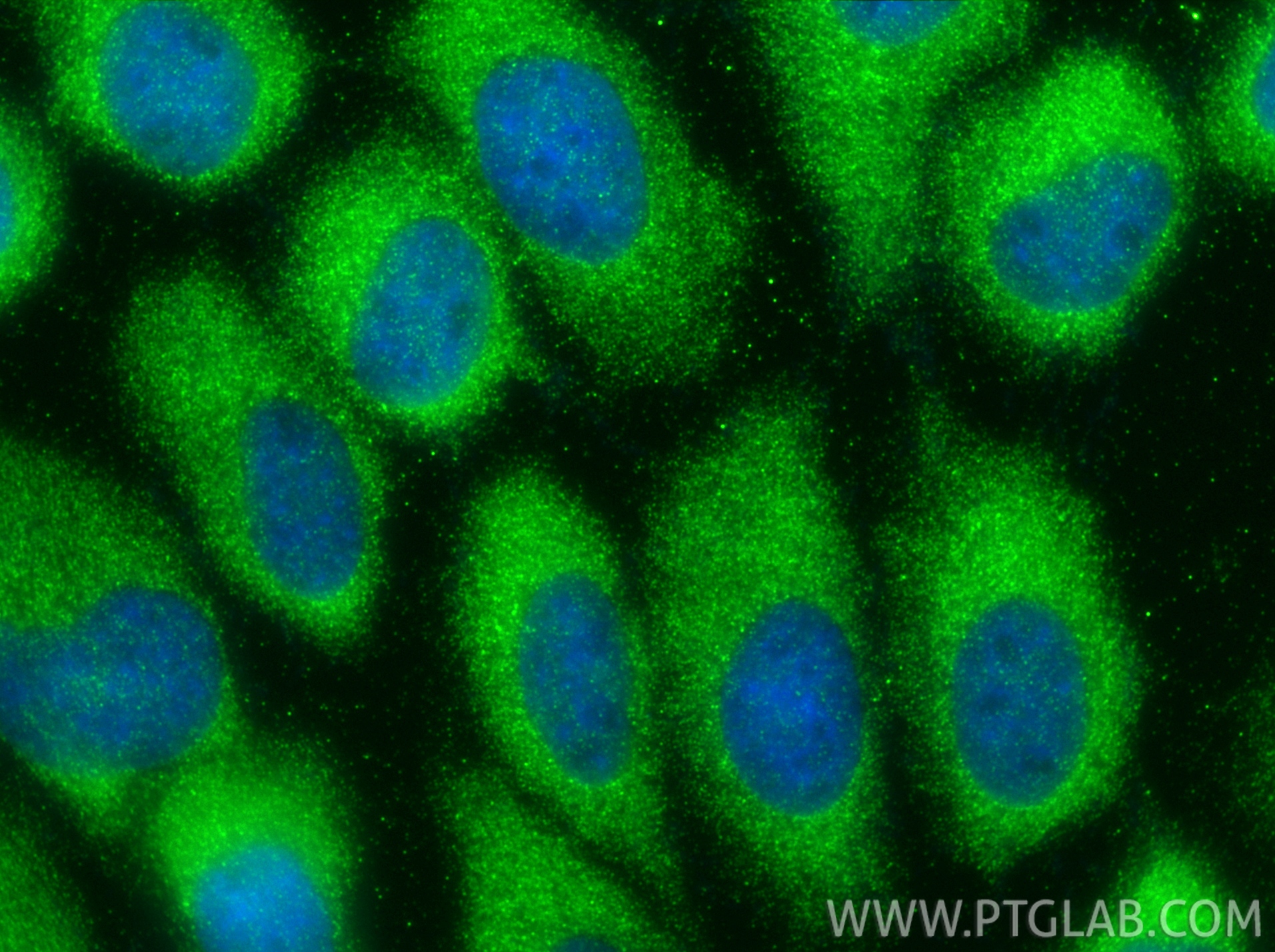 Immunofluorescence (IF) / fluorescent staining of A431 cells using LIF Polyclonal antibody (26757-1-AP)
