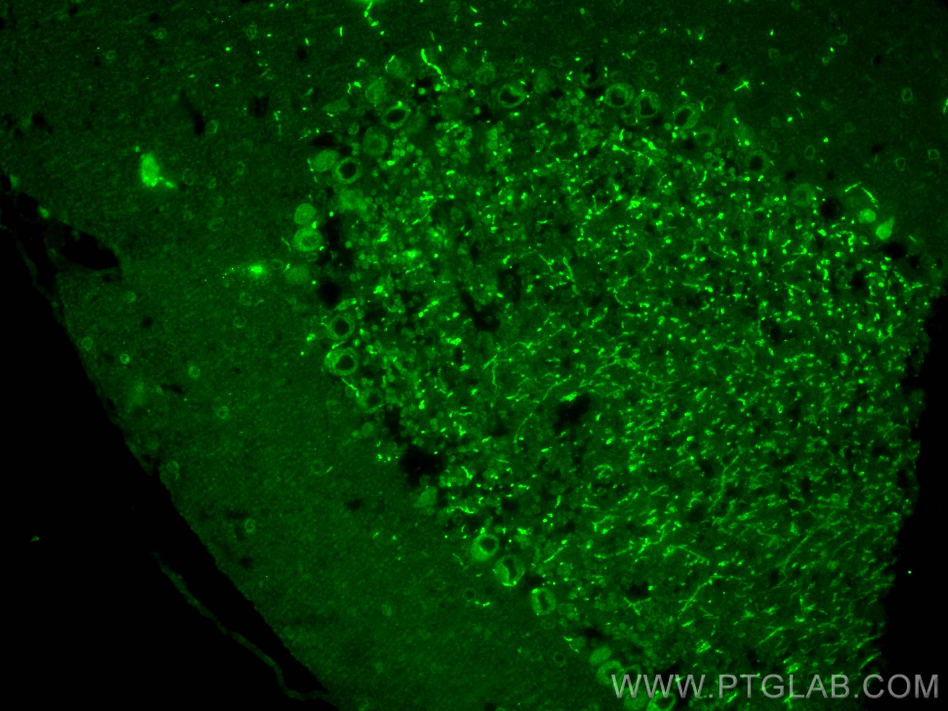 Immunofluorescence (IF) / fluorescent staining of mouse cerebellum tissue using LIFR Polyclonal antibody (22779-1-AP)