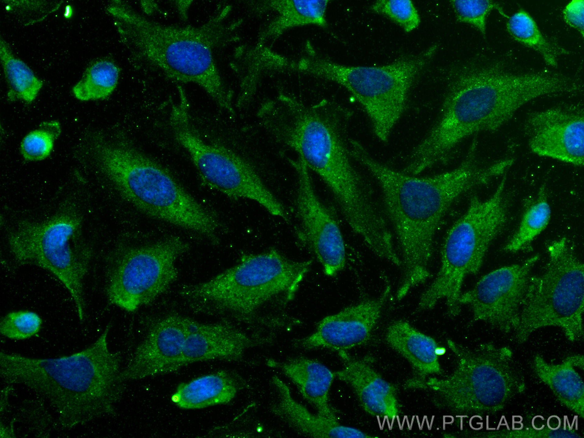 Immunofluorescence (IF) / fluorescent staining of HeLa cells using LIFR Polyclonal antibody (22779-1-AP)