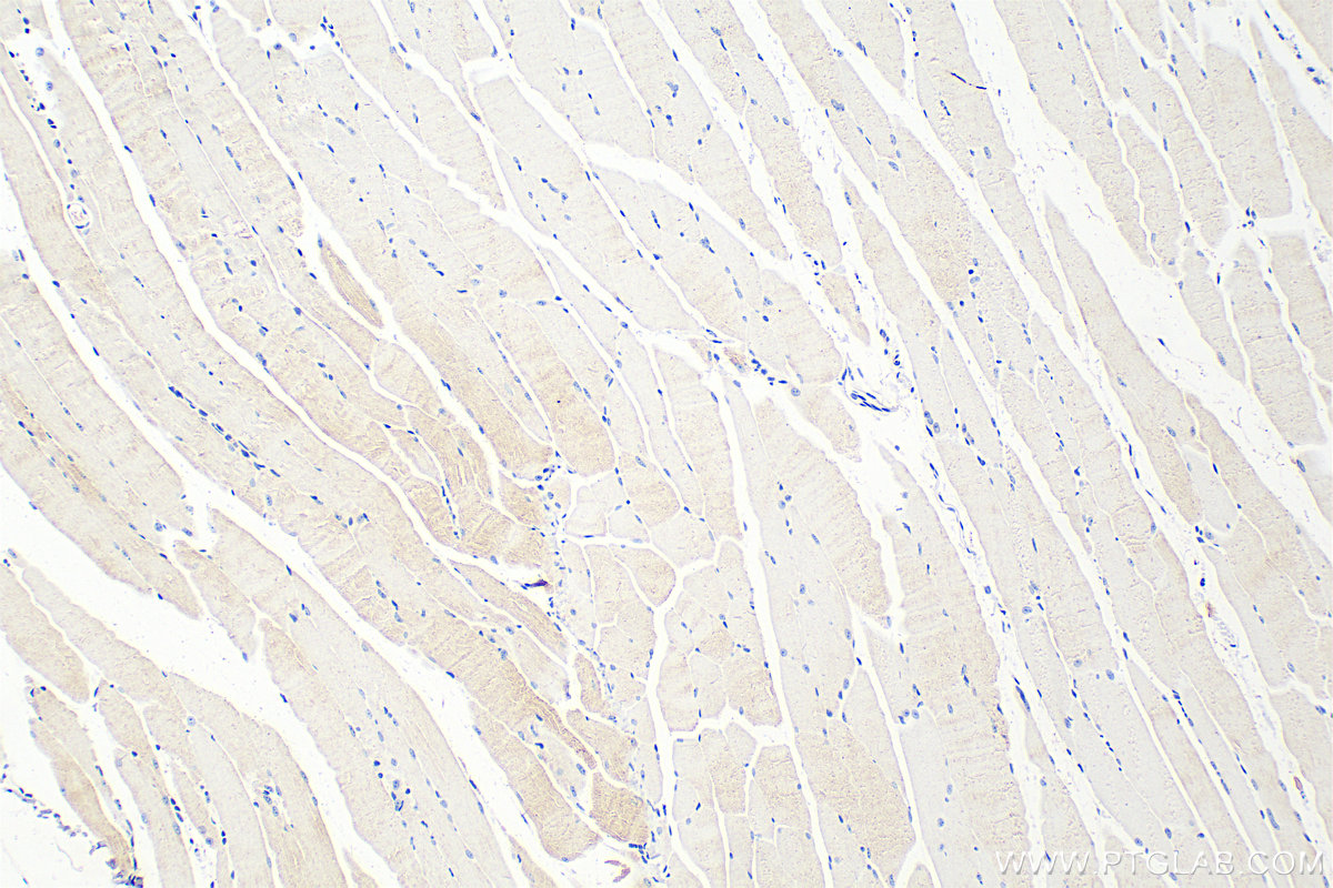 Immunohistochemistry (IHC) staining of mouse skeletal muscle tissue using LIFR Polyclonal antibody (22779-1-AP)