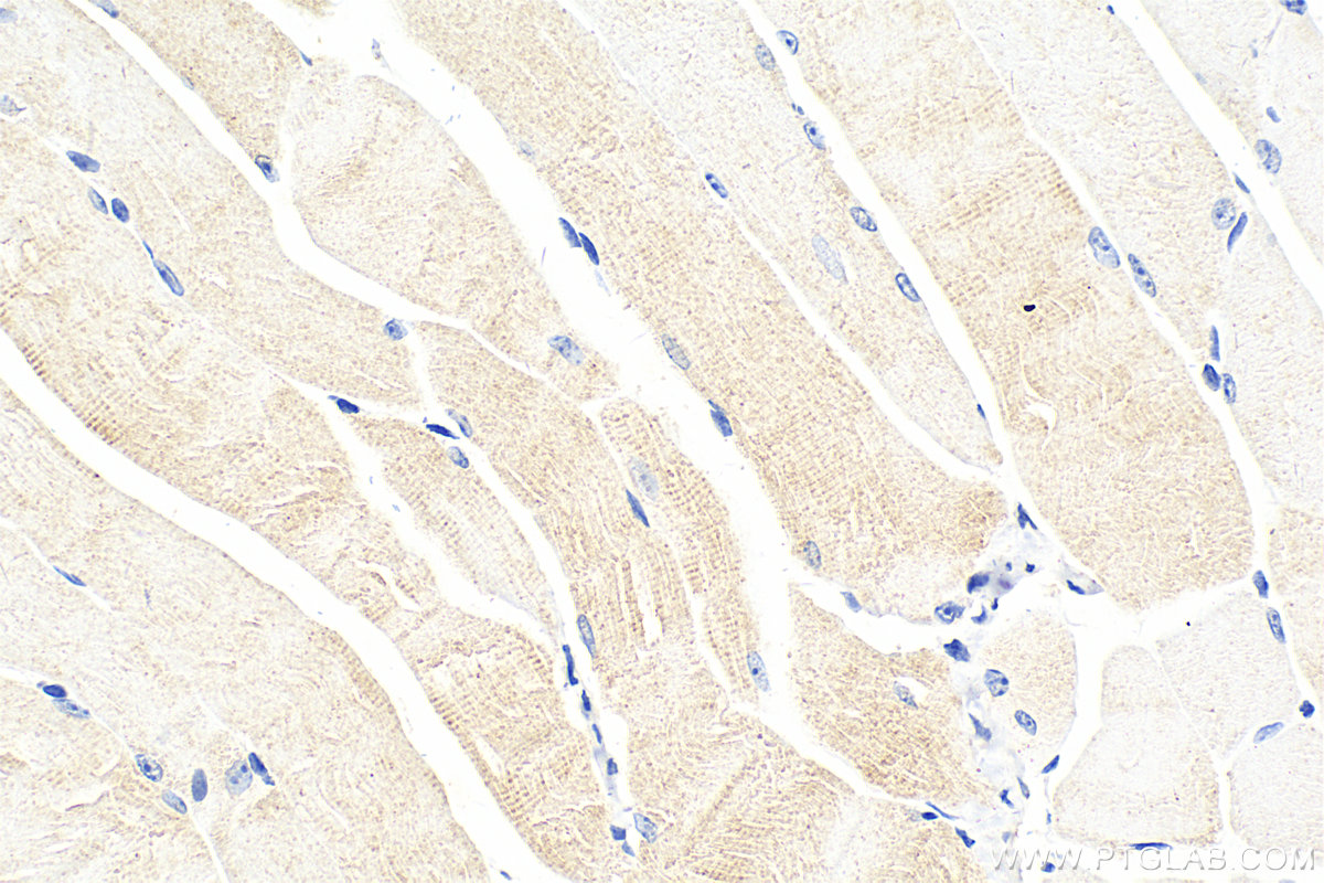 Immunohistochemistry (IHC) staining of mouse skeletal muscle tissue using LIFR Polyclonal antibody (22779-1-AP)