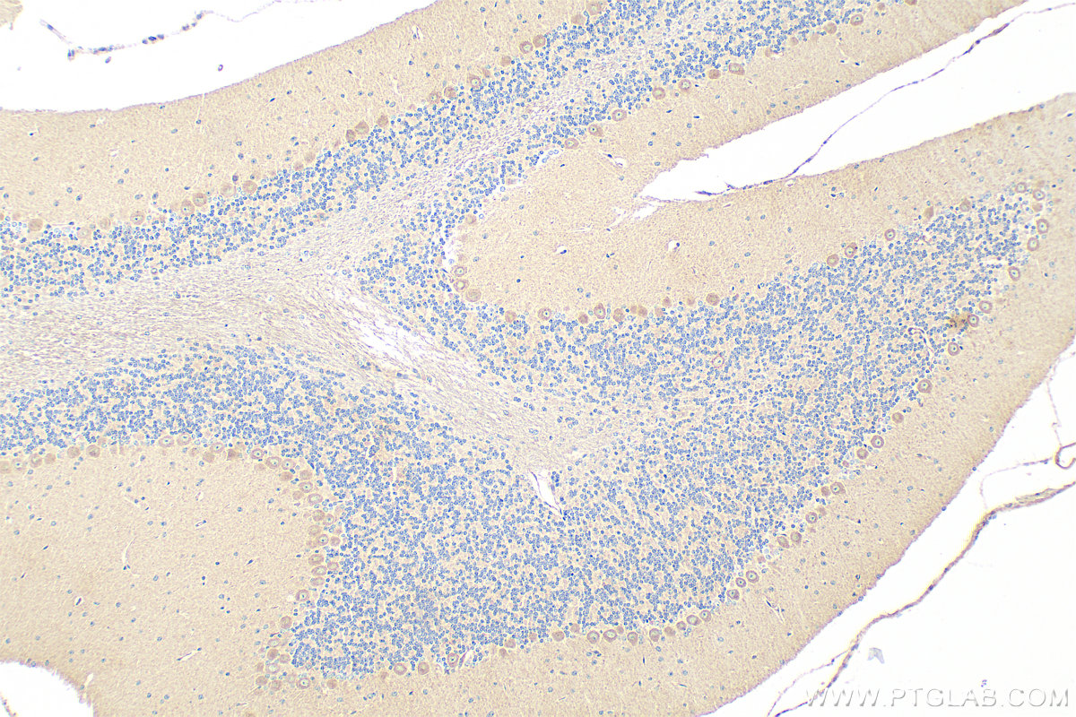 Immunohistochemistry (IHC) staining of mouse cerebellum tissue using LIFR Polyclonal antibody (22779-1-AP)