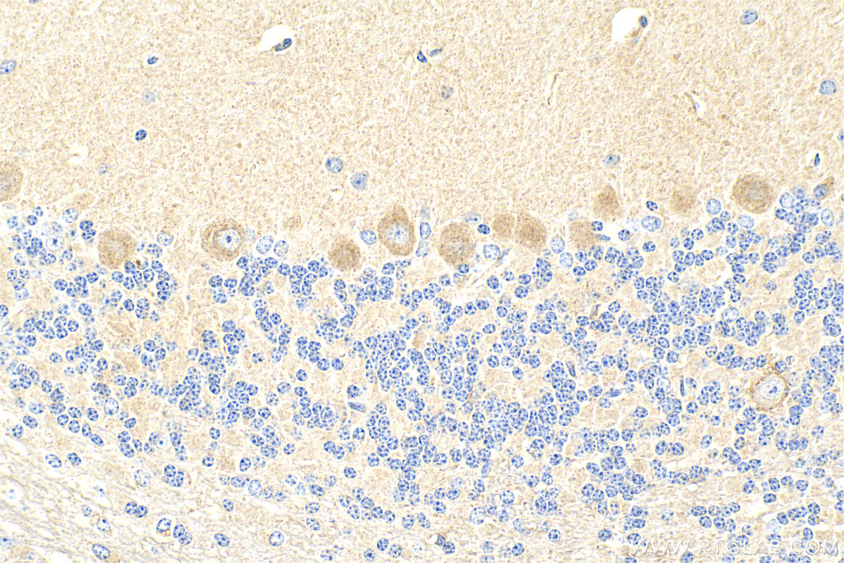 Immunohistochemistry (IHC) staining of mouse cerebellum tissue using LIFR Polyclonal antibody (22779-1-AP)