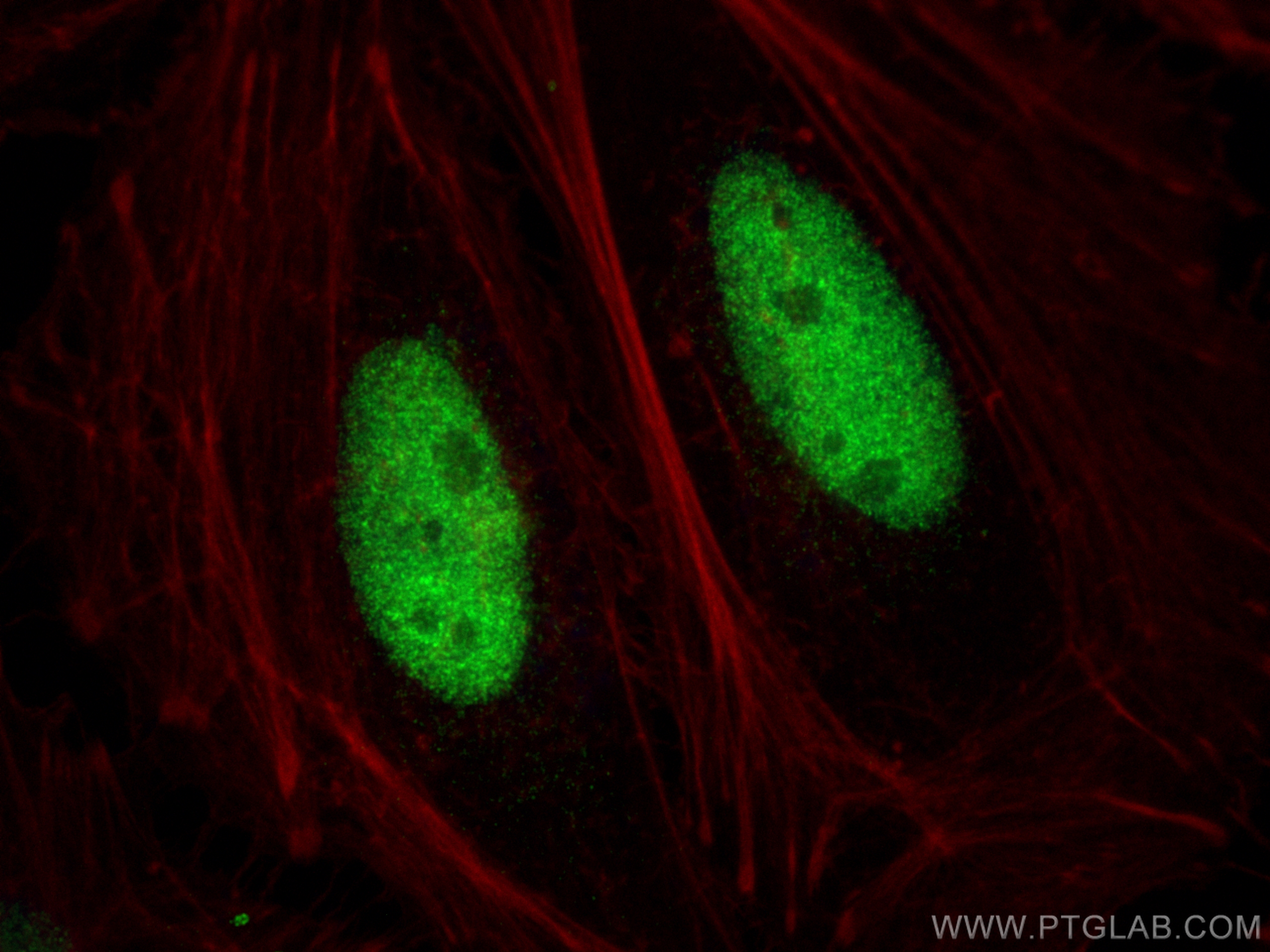 Immunofluorescence (IF) / fluorescent staining of HeLa cells using LIG3 Polyclonal antibody (26583-1-AP)