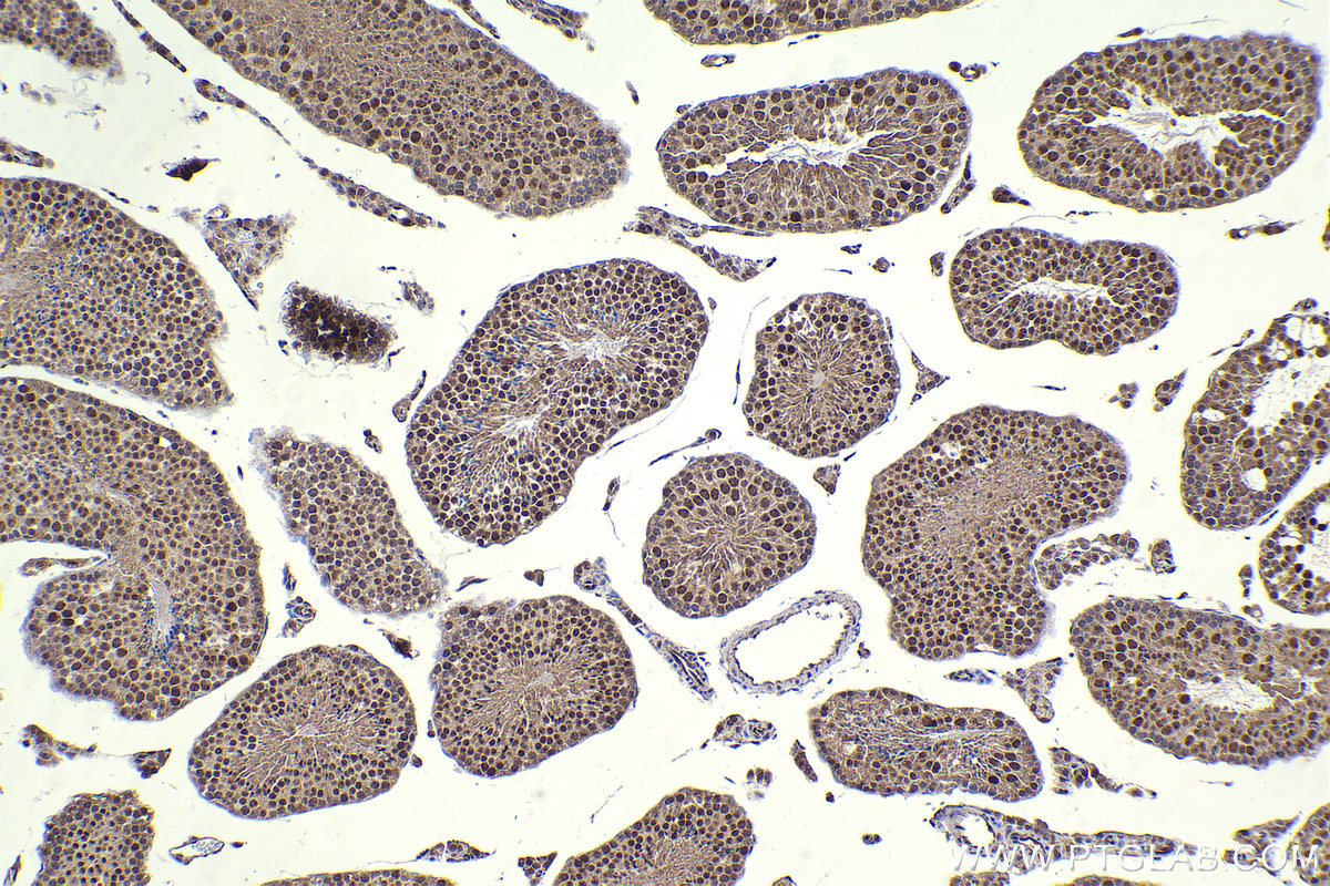 Immunohistochemistry (IHC) staining of mouse testis tissue using LIG3 Polyclonal antibody (26583-1-AP)