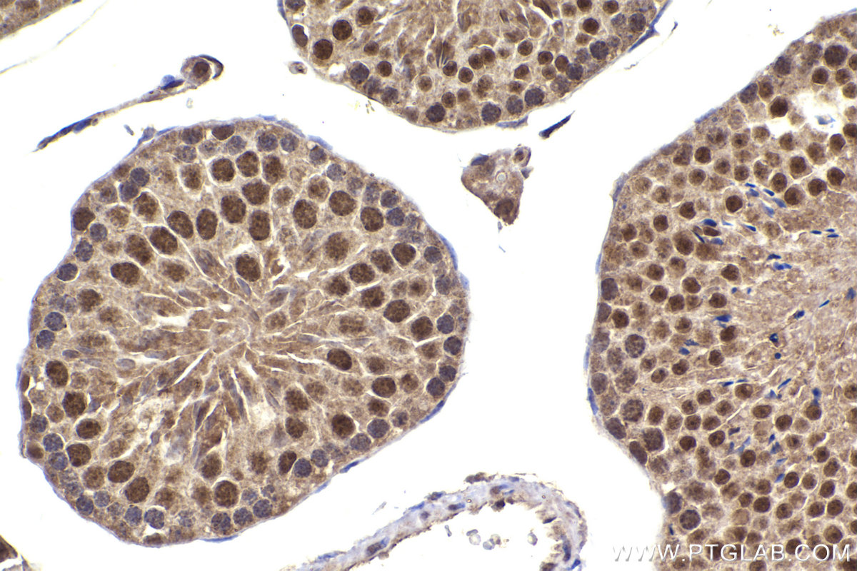 Immunohistochemistry (IHC) staining of mouse testis tissue using LIG3 Polyclonal antibody (26583-1-AP)