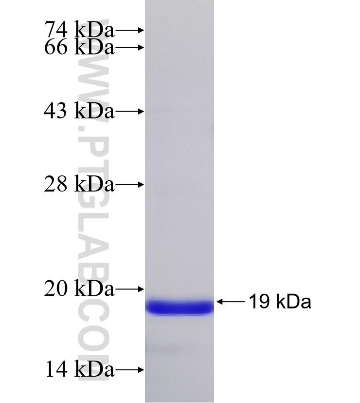 LIG3 fusion protein Ag31484 SDS-PAGE