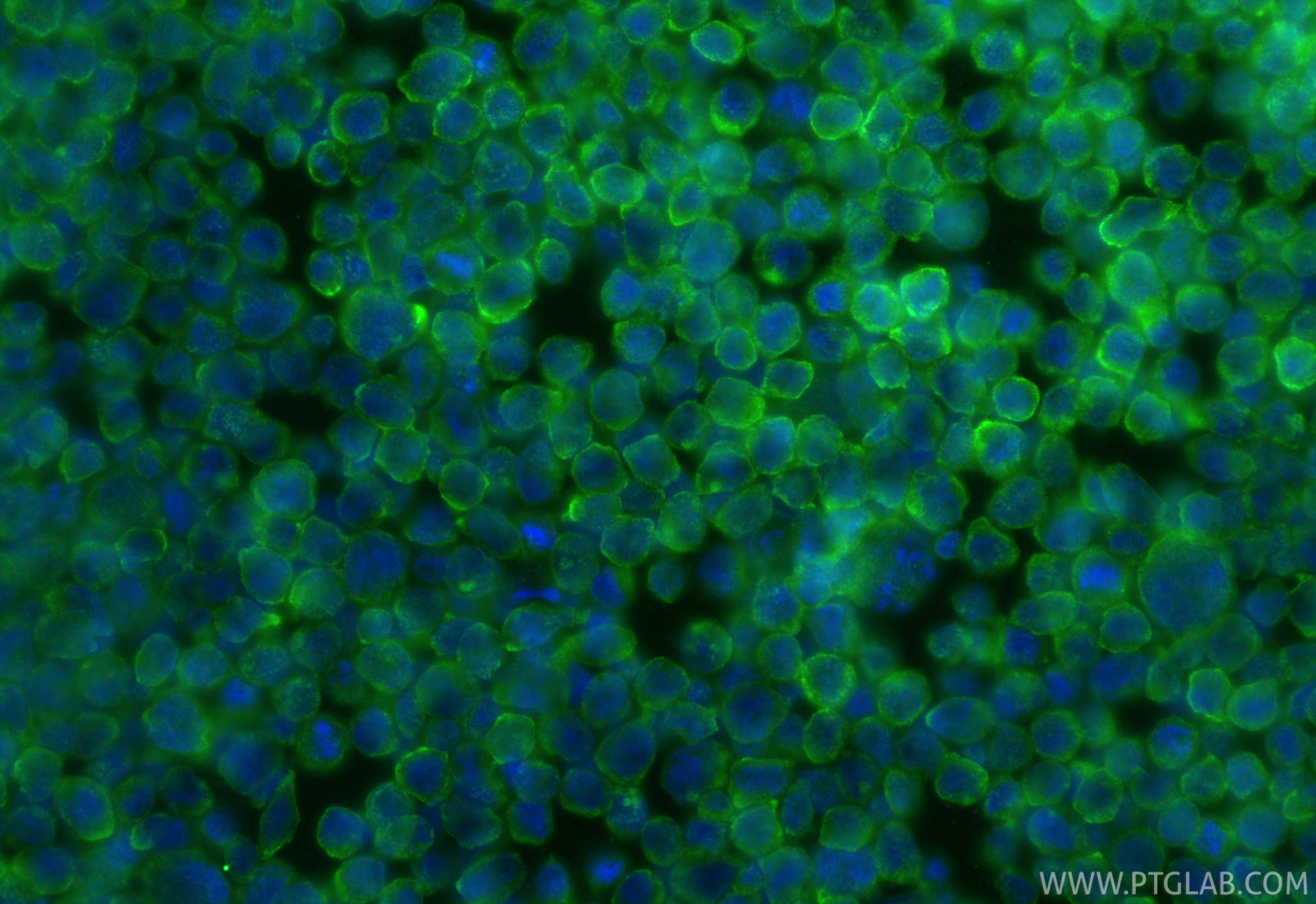 Immunofluorescence (IF) / fluorescent staining of HL-60 cells using LILRA4 Polyclonal antibody (21153-1-AP)