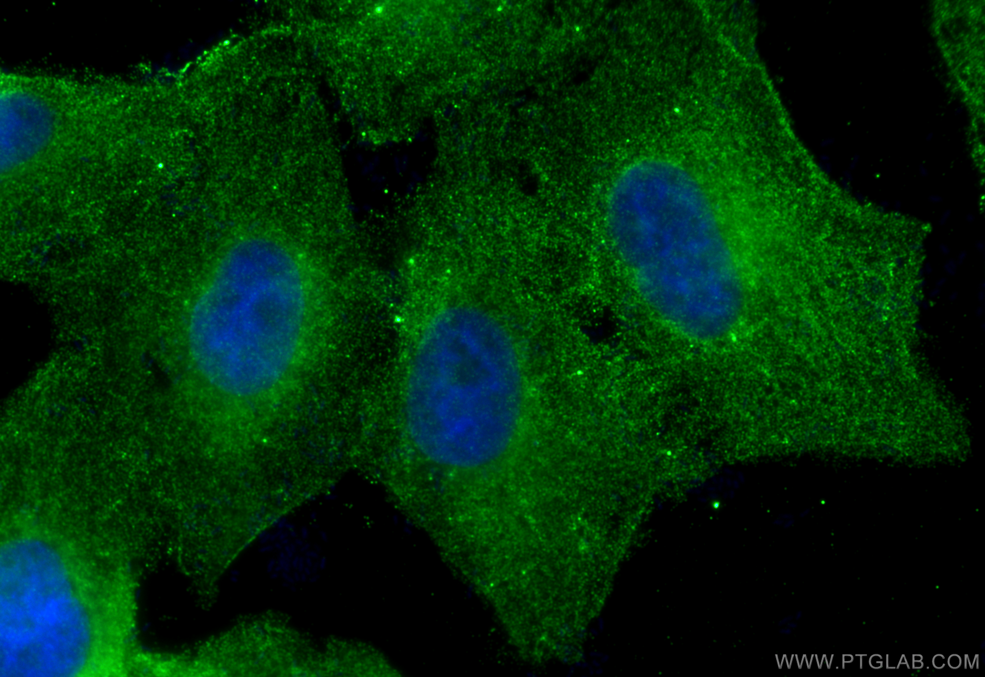 Immunofluorescence (IF) / fluorescent staining of A549 cells using LILRB4 Monoclonal antibody (67119-1-Ig)