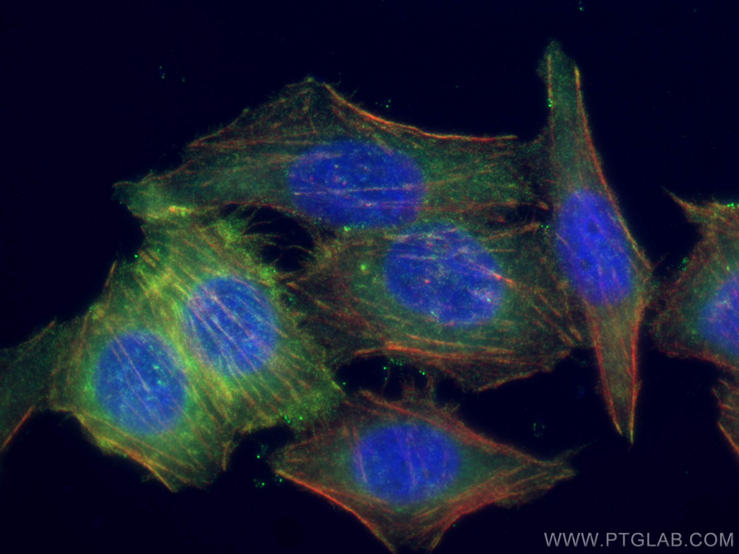 Immunofluorescence (IF) / fluorescent staining of PC-3 cells using EPLIN Polyclonal antibody (16639-1-AP)