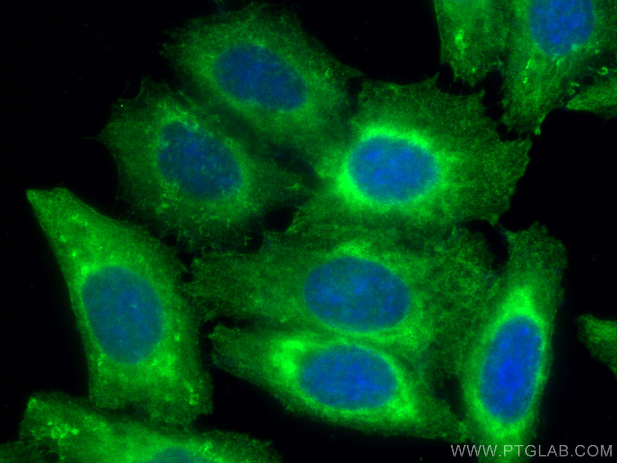 Immunofluorescence (IF) / fluorescent staining of HepG2 cells using EPLIN Polyclonal antibody (16639-1-AP)