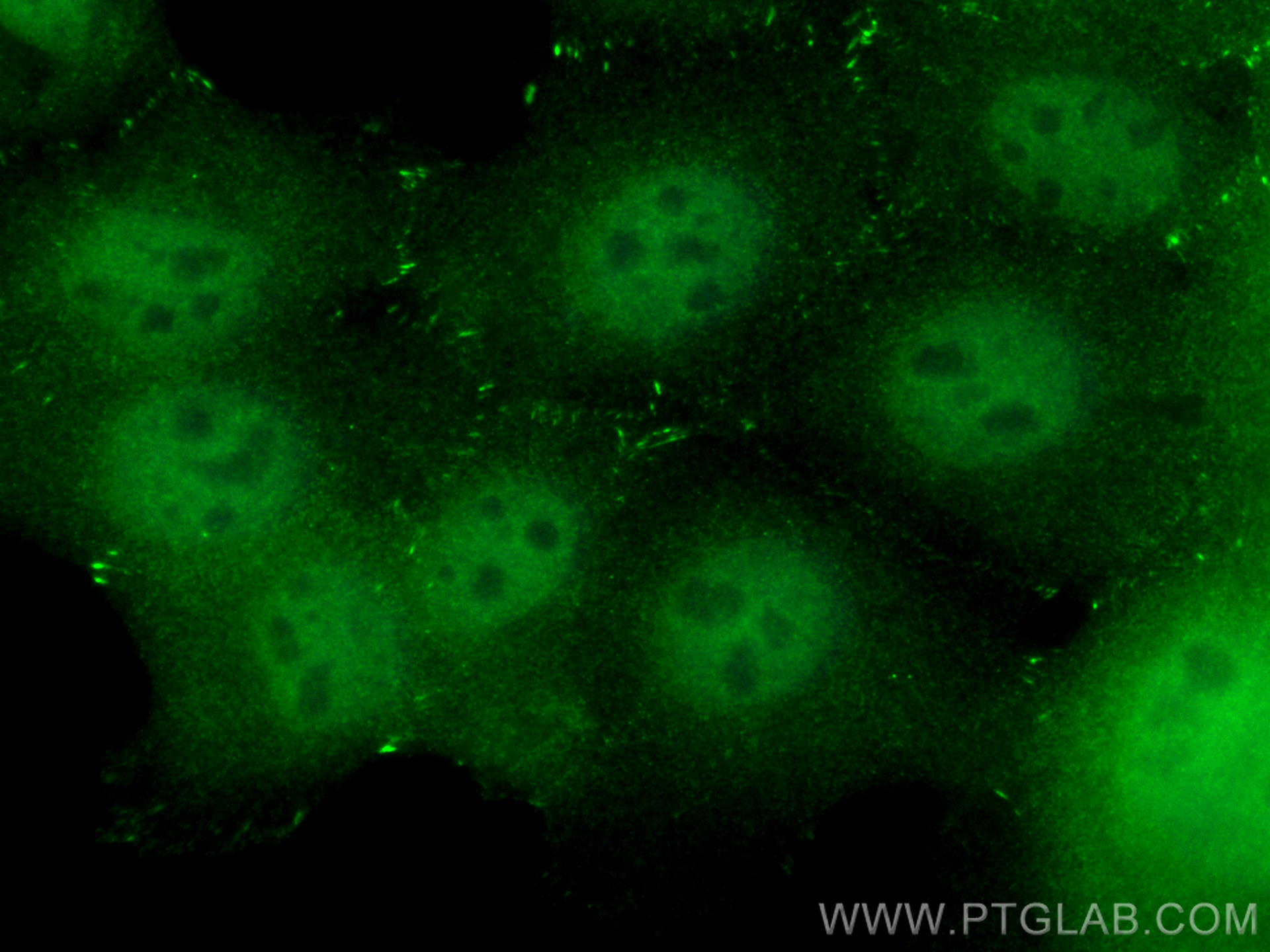 Immunofluorescence (IF) / fluorescent staining of A431 cells using CoraLite® Plus 488-conjugated LIMD1 Polyclonal ant (CL488-28106)