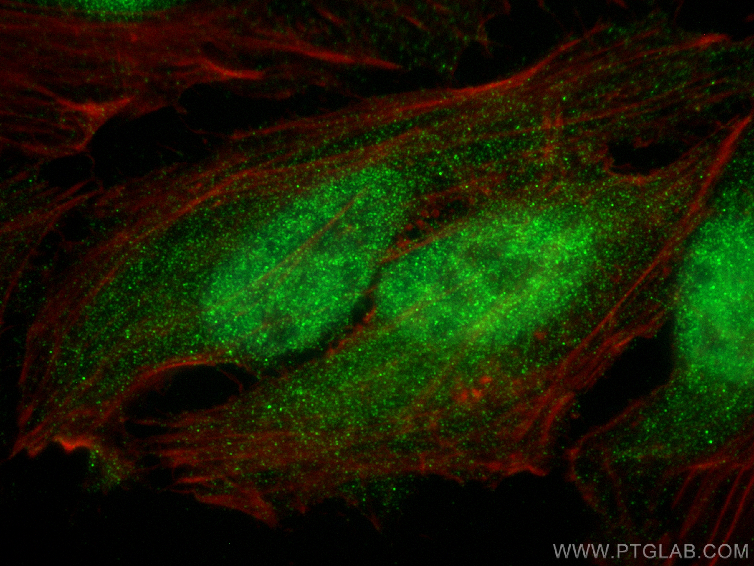 Immunofluorescence (IF) / fluorescent staining of HeLa cells using LIMK1 Polyclonal antibody (19699-1-AP)