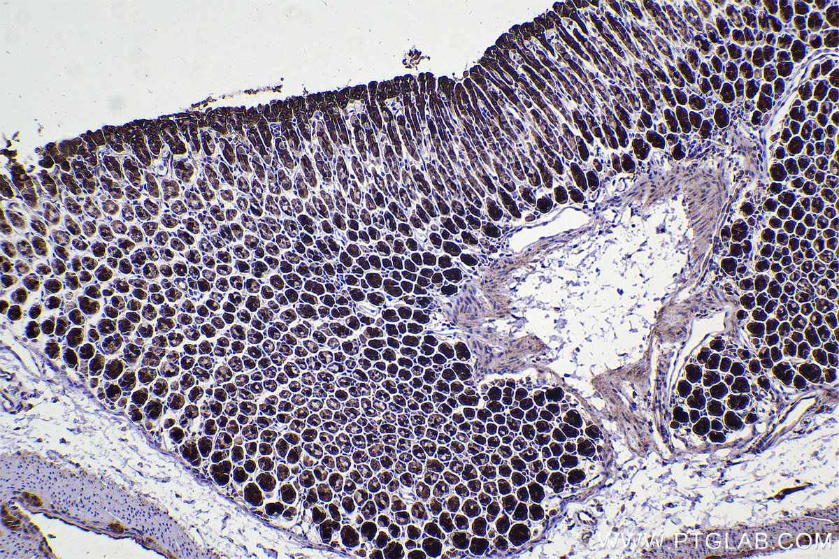 Immunohistochemistry (IHC) staining of mouse stomach tissue using LIMK1 Monoclonal antibody (67974-1-Ig)