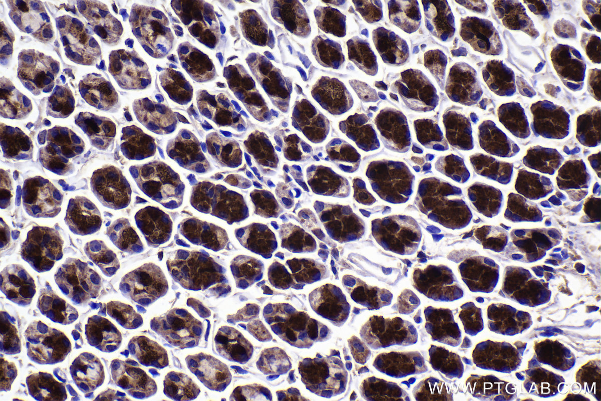 Immunohistochemistry (IHC) staining of mouse stomach tissue using LIMK1 Monoclonal antibody (67974-1-Ig)