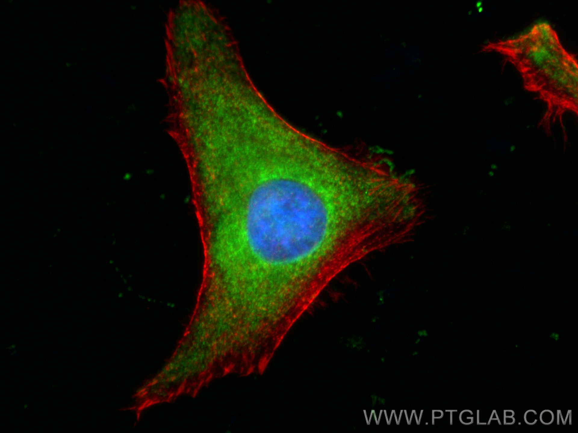 LIMK1 antibody (CL48867974) Proteintech