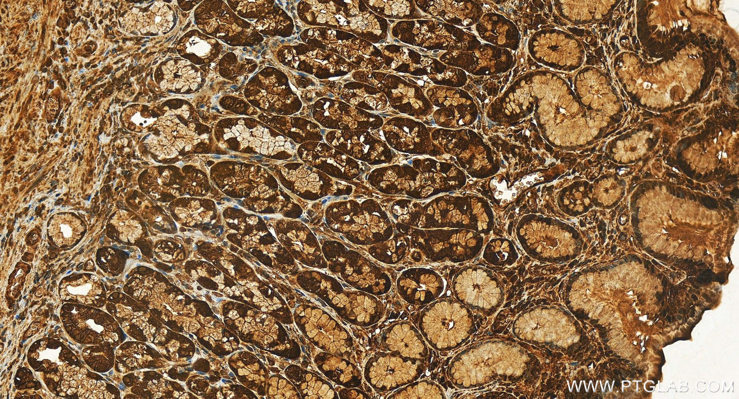 Immunohistochemistry (IHC) staining of human stomach tissue using LIMK2 Polyclonal antibody (12350-1-AP)