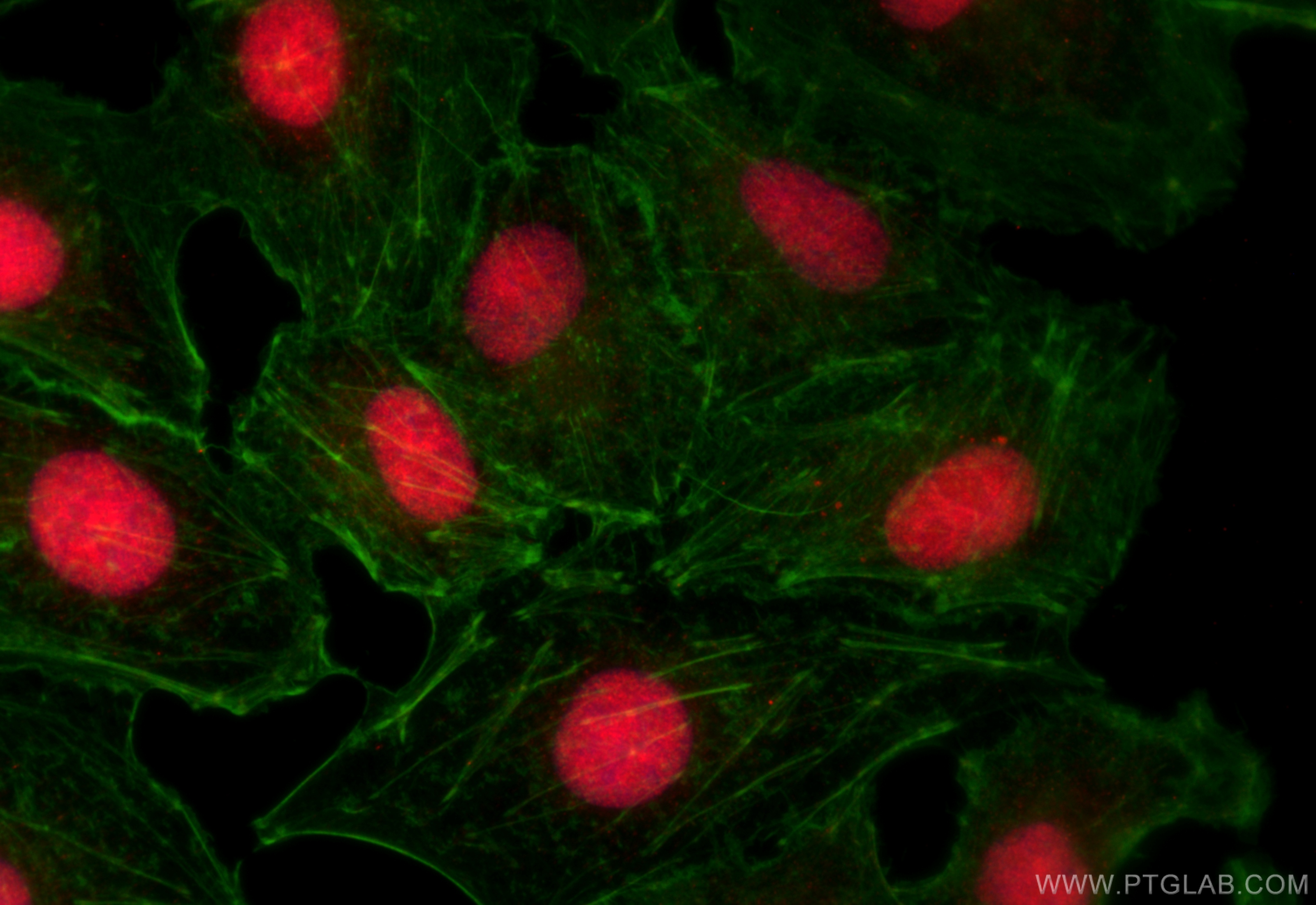 Immunofluorescence (IF) / fluorescent staining of A549 cells using LIN37 Polyclonal antibody (26651-1-AP)