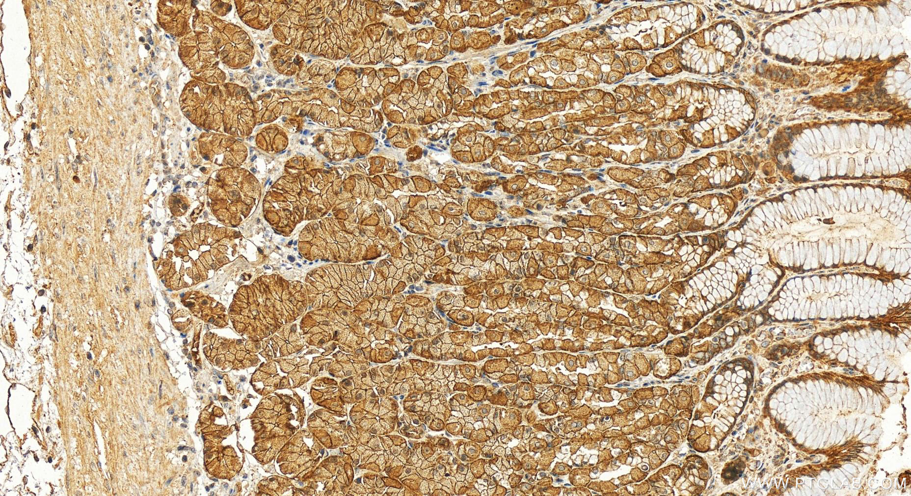 Immunohistochemistry (IHC) staining of human stomach tissue using LIN7C Polyclonal antibody (14656-1-AP)