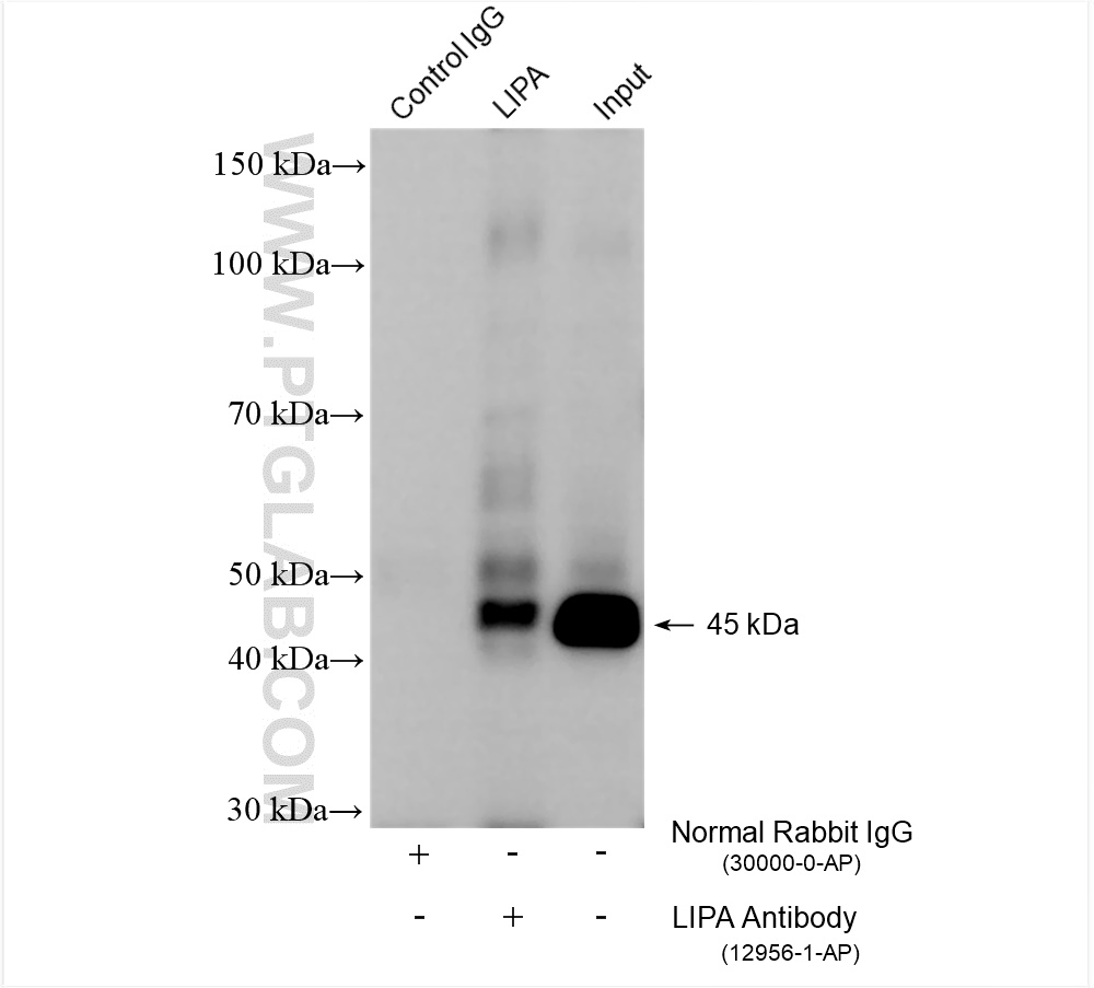 Immunoprecipitation (IP) experiment of HT-1080 cells using LIPA Polyclonal antibody (12956-1-AP)