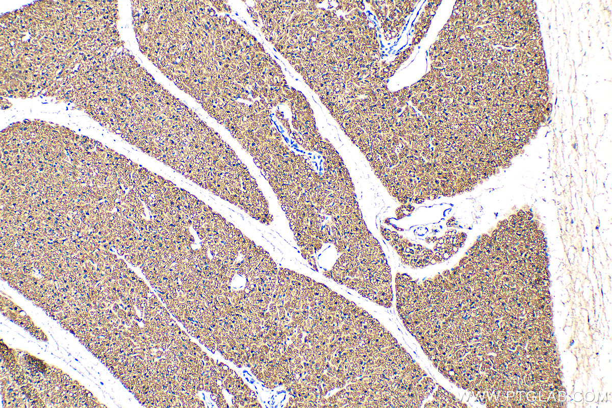 Immunohistochemistry (IHC) staining of mouse brown adipose tissue using HSL Polyclonal antibody (17333-1-AP)