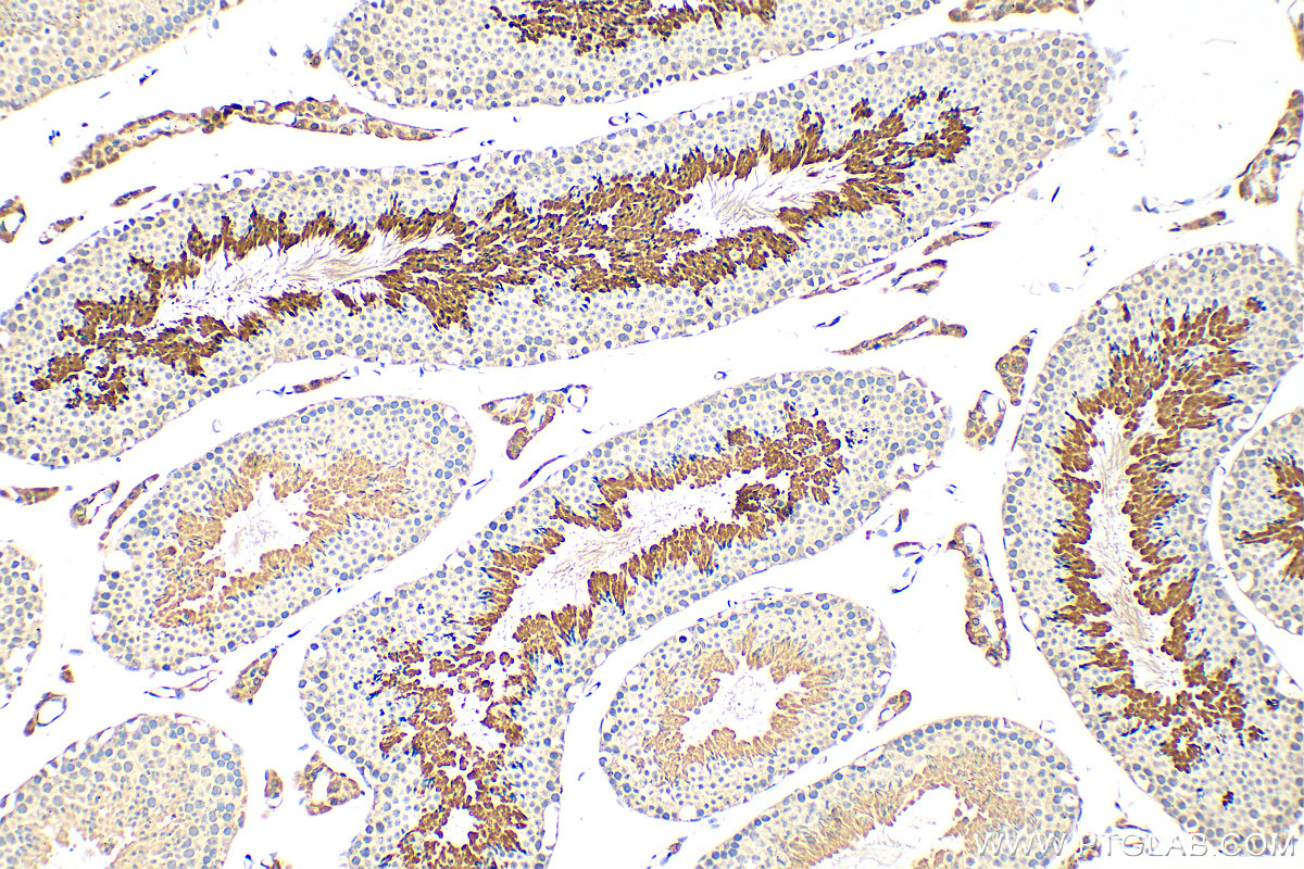 Immunohistochemistry (IHC) staining of mouse testis tissue using HSL Polyclonal antibody (17333-1-AP)