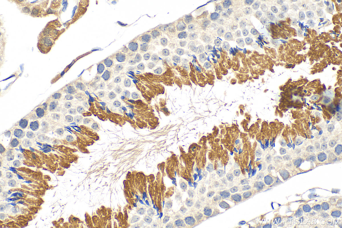 Immunohistochemistry (IHC) staining of mouse testis tissue using HSL Polyclonal antibody (17333-1-AP)