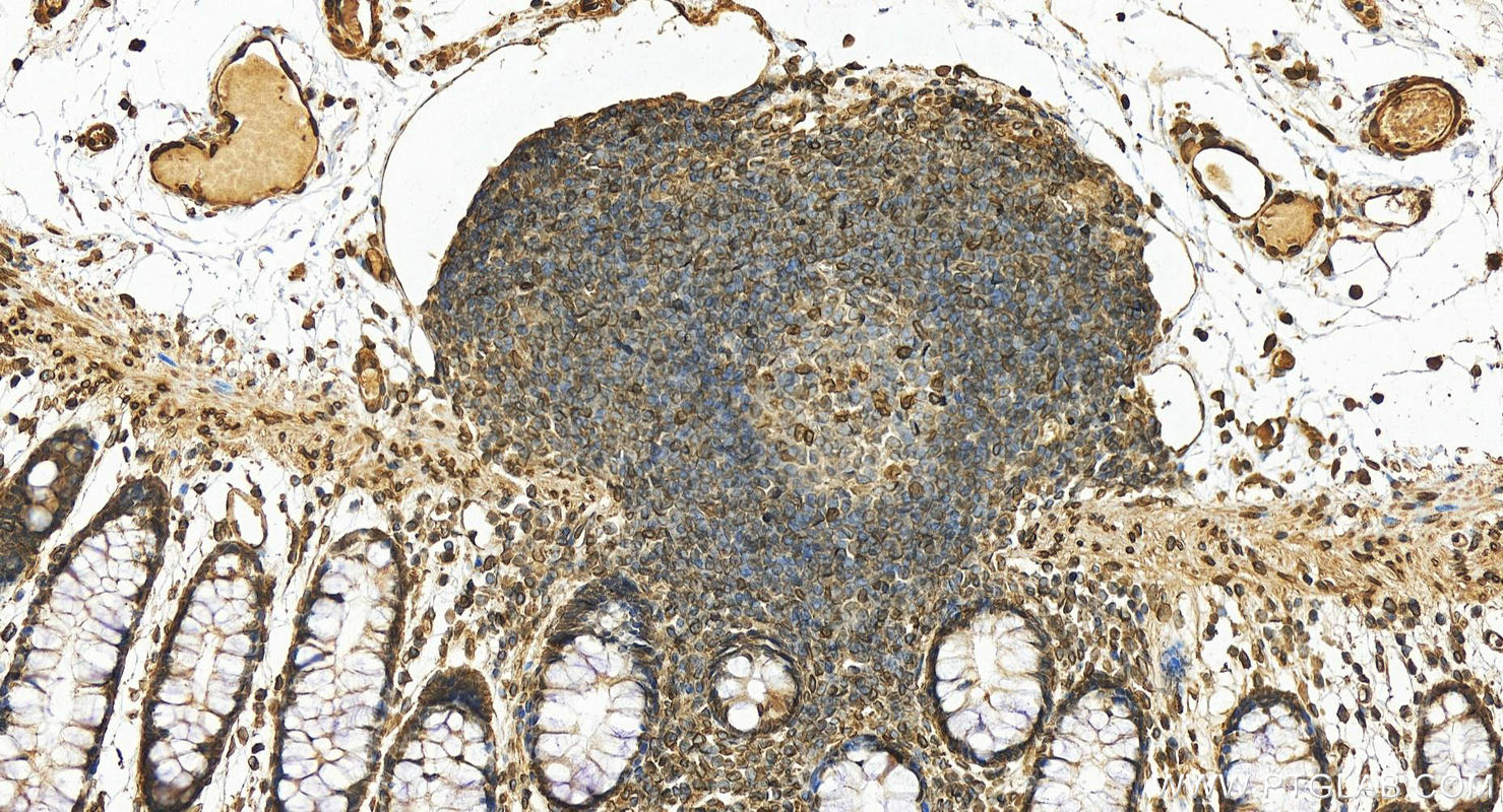 Immunohistochemistry (IHC) staining of human colon tissue using Lamin B2 Polyclonal antibody (10895-1-AP)