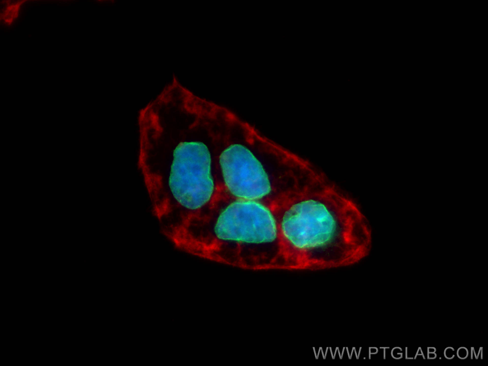 Immunofluorescence (IF) / fluorescent staining of Caco-2 cells using Lamin B2 Polyclonal antibody (10895-1-AP)