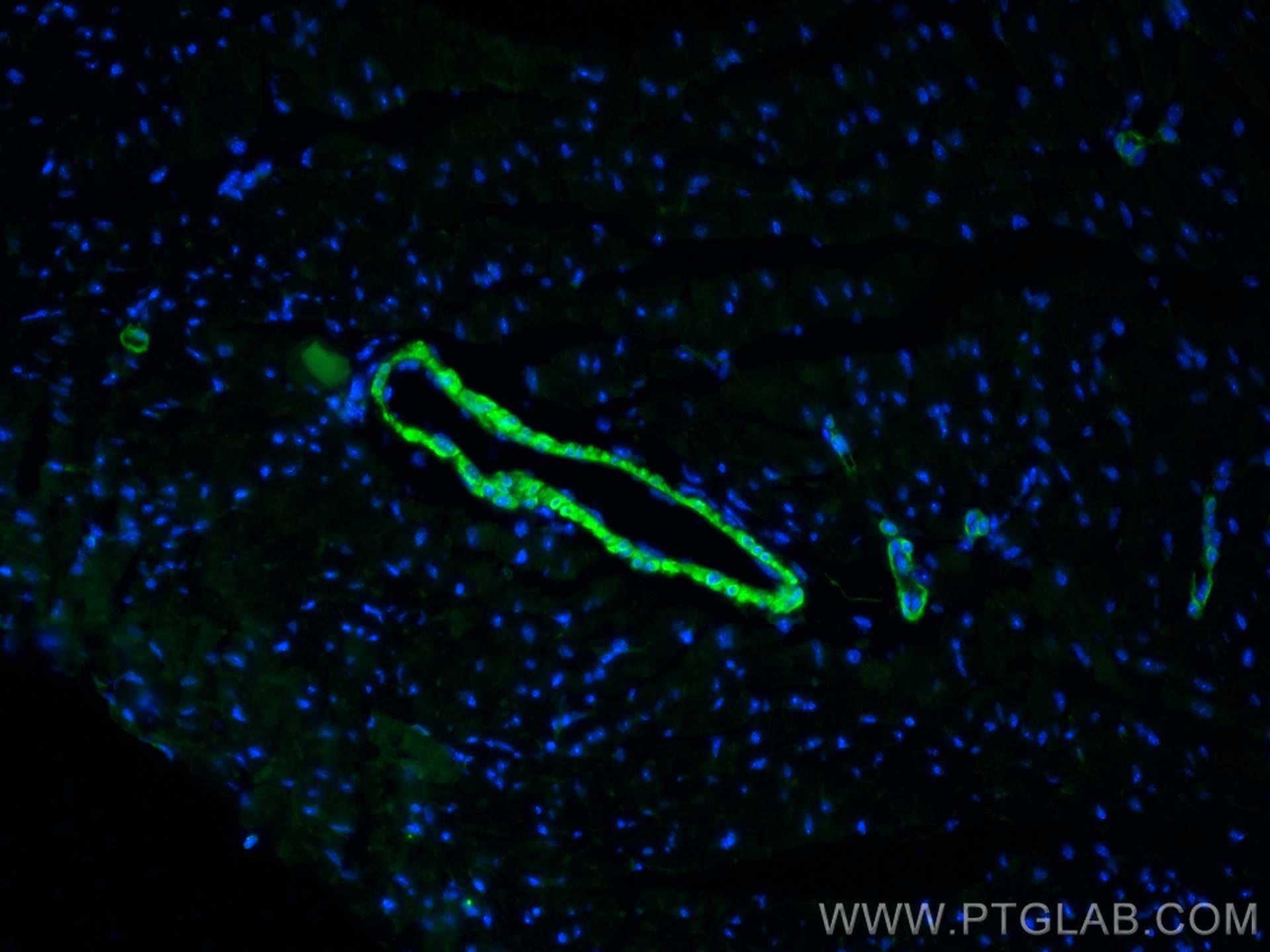 Immunofluorescence (IF) / fluorescent staining of mouse heart tissue using LMOD1 Polyclonal antibody (15117-1-AP)