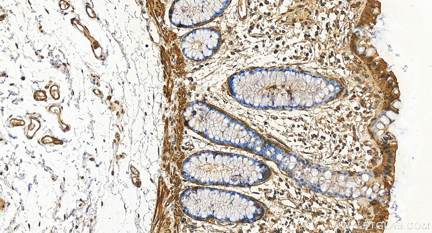 Immunohistochemistry (IHC) staining of human colon tissue using LMOD1 Monoclonal antibody (60414-1-Ig)