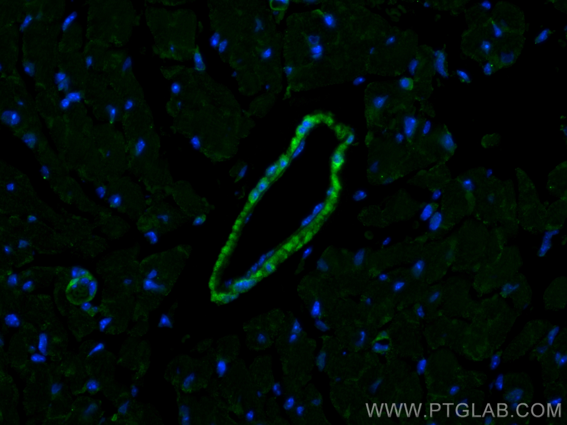 Immunofluorescence (IF) / fluorescent staining of mouse heart tissue using LMOD1 Monoclonal antibody (60414-1-Ig)