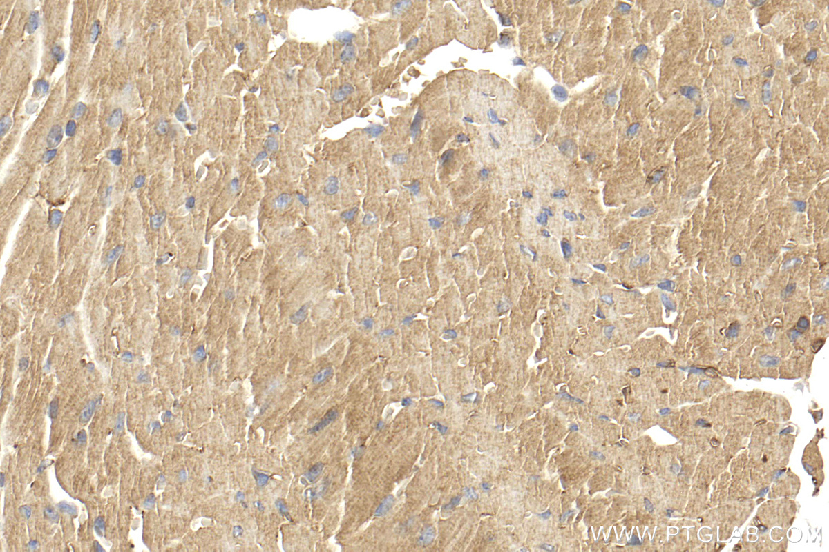 Immunohistochemistry (IHC) staining of mouse heart tissue using LMOD3 Polyclonal antibody (14948-1-AP)