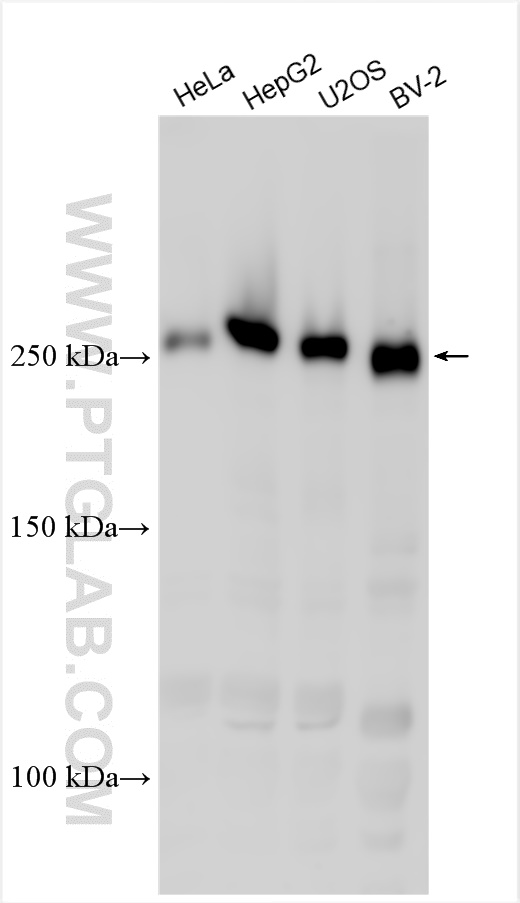 Western Blot (WB) analysis of various lysates using LMTK2 Polyclonal antibody (31540-1-AP)