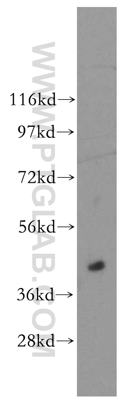 Western Blot (WB) analysis of human brain tissue using ACOT7L Polyclonal antibody (51016-2-AP)