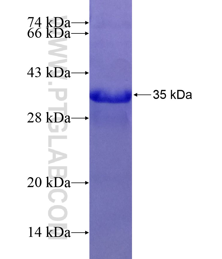 LOC643008 fusion protein Ag29341 SDS-PAGE