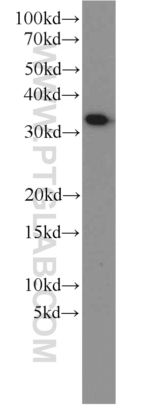 Western Blot (WB) analysis of human brain tissue using MEF2BNB Polyclonal antibody (10931-1-AP)