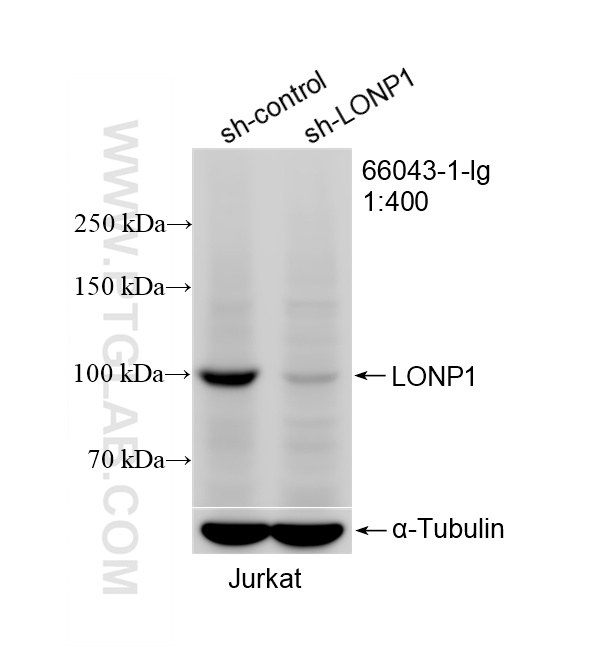 Western Blot (WB) analysis of Jurkat cells using LONP1 Monoclonal antibody (66043-1-Ig)