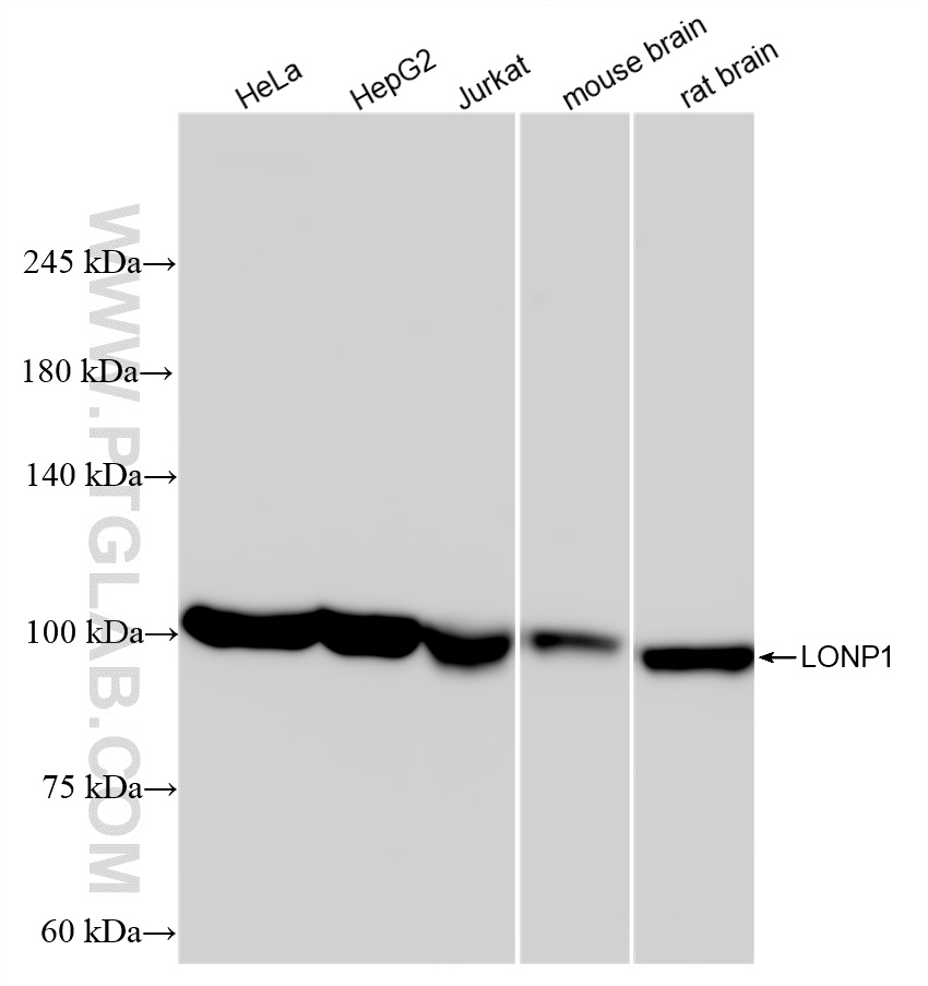Western Blot (WB) analysis of various lysates using LONP1 Recombinant antibody (83552-2-RR)