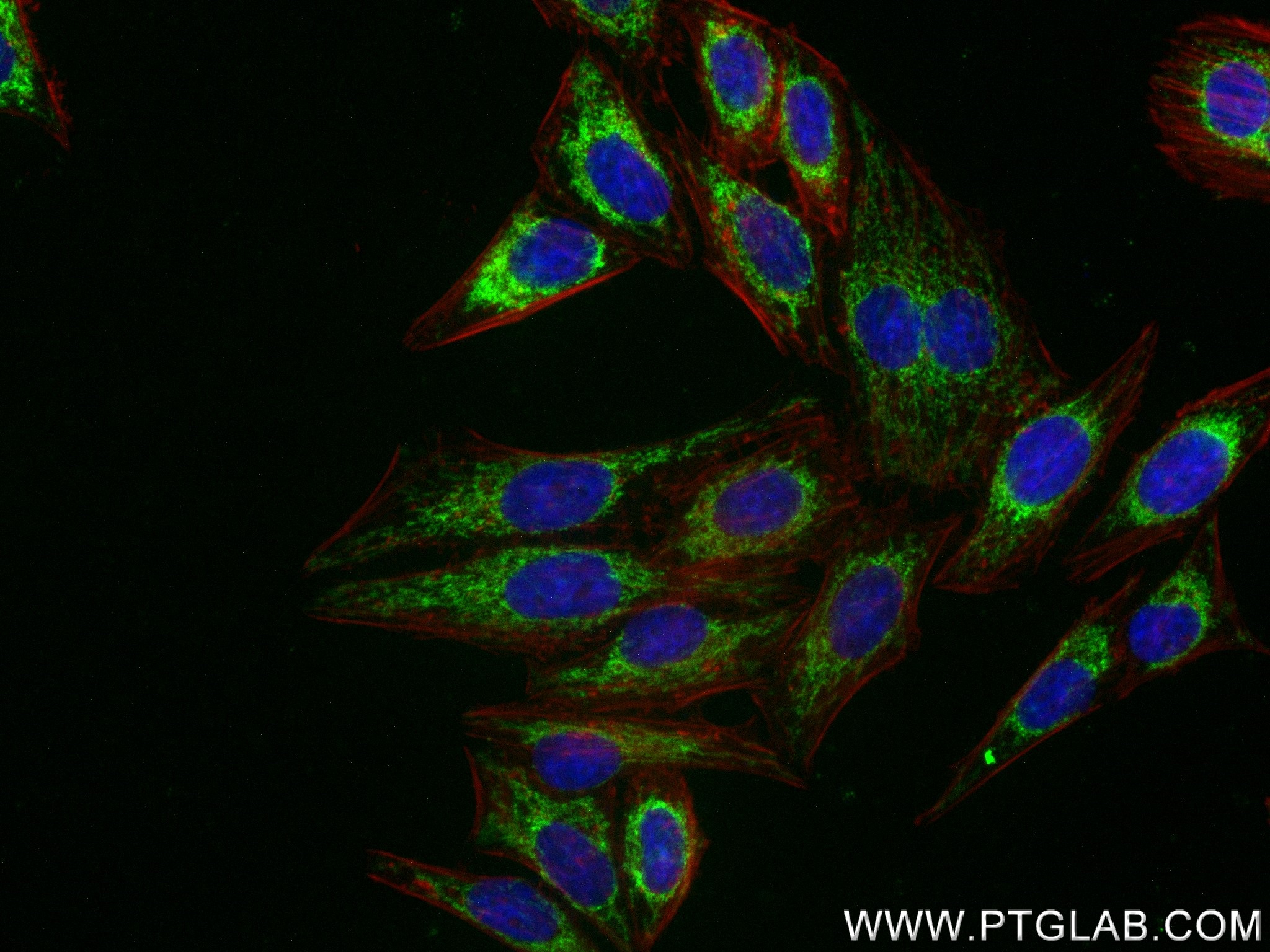 Immunofluorescence (IF) / fluorescent staining of HepG2 cells using LONP1 Recombinant antibody (83552-3-RR)