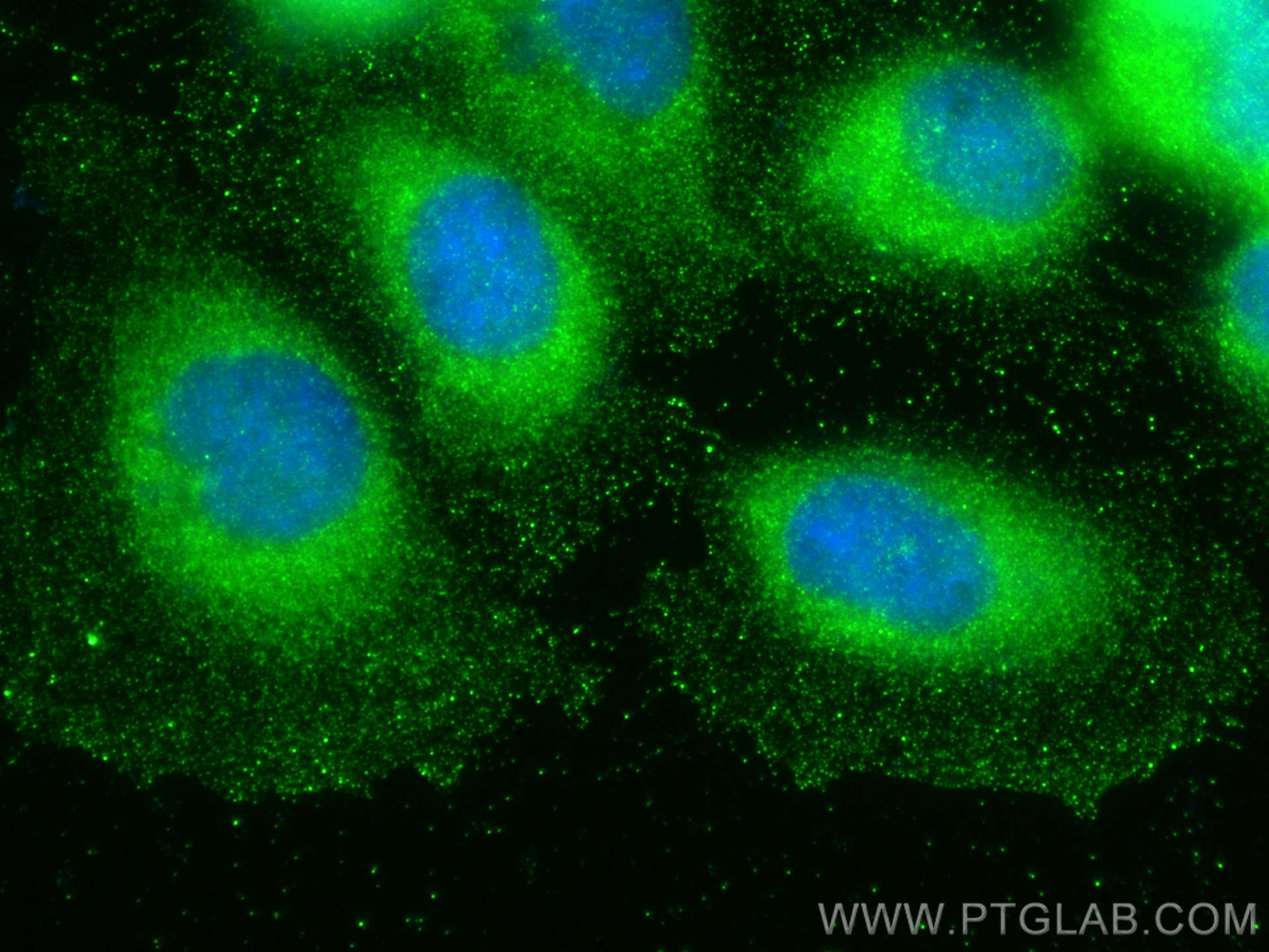 Immunofluorescence (IF) / fluorescent staining of A431 cells using Loricrin Polyclonal antibody (55439-1-AP)