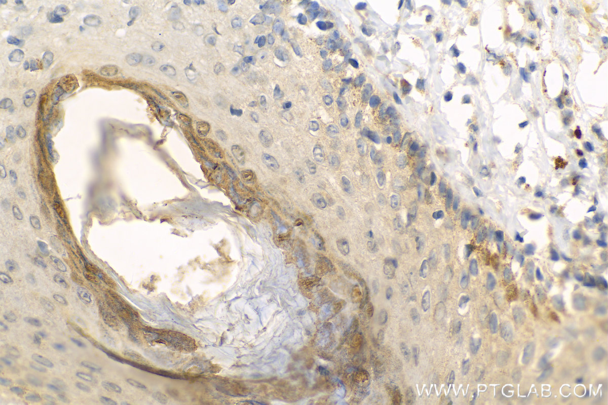 Immunohistochemistry (IHC) staining of human paracancerous tissue of skin using Loricrin Polyclonal antibody (55439-1-AP)