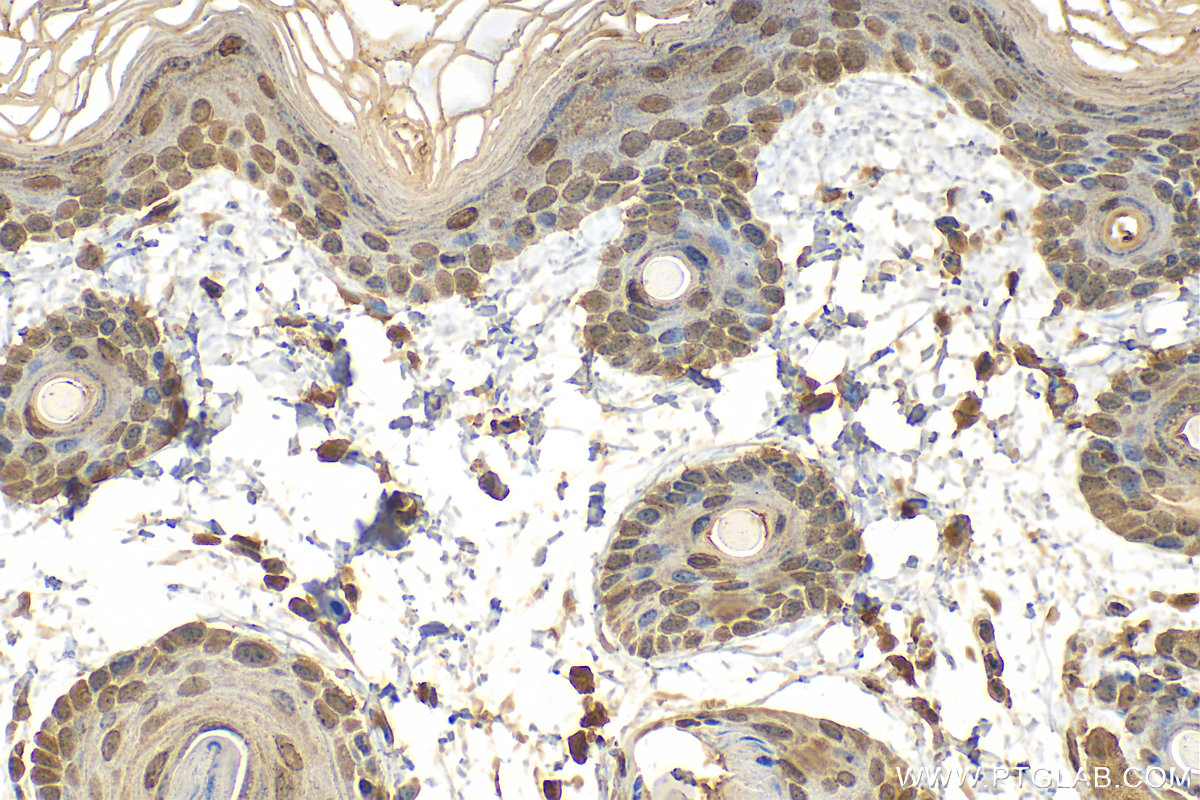 Immunohistochemistry (IHC) staining of mouse skin tissue using Loricrin Polyclonal antibody (55439-1-AP)