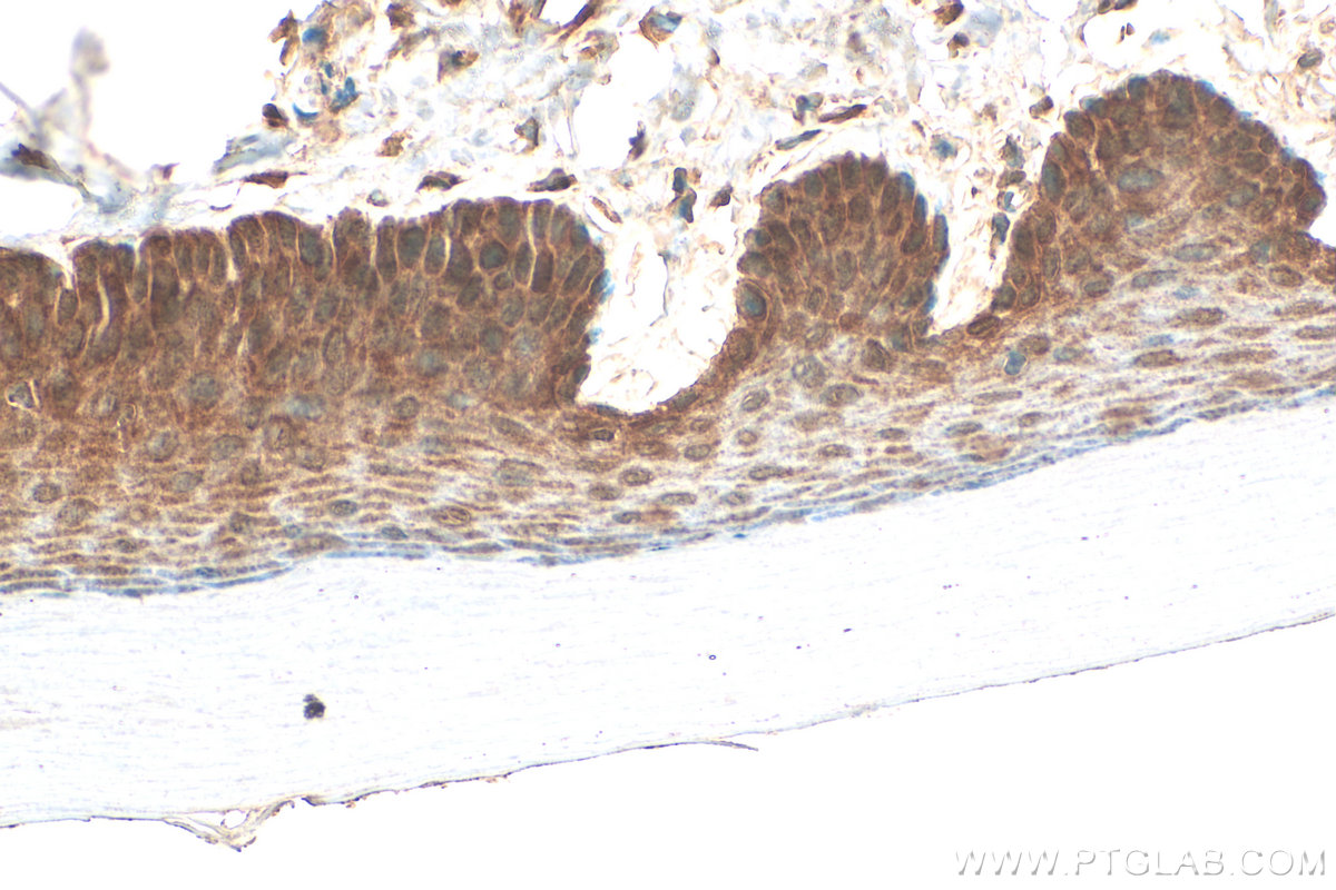 Immunohistochemistry (IHC) staining of mouse skin tissue using Loricrin Polyclonal antibody (55439-1-AP)