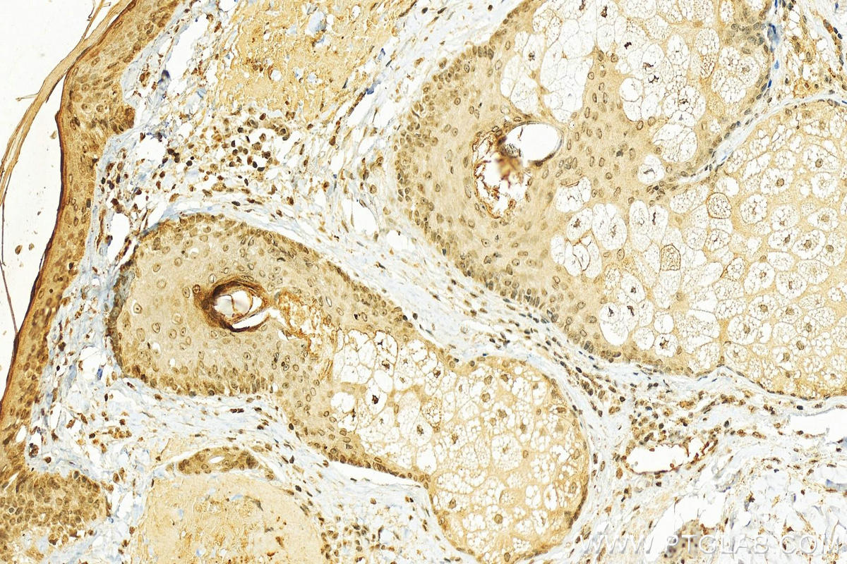 Immunohistochemistry (IHC) staining of human paracancerous using Loricrin Polyclonal antibody (55439-1-AP)